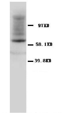 HSP60/HSPD1 Antibody