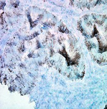 HSP60 antibody