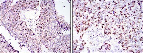 HSP60 Antibody