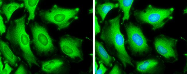 Hsp70 antibody
