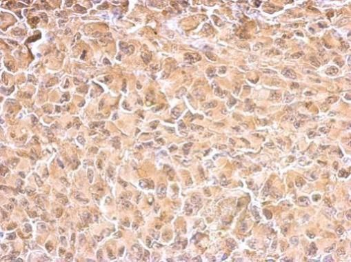 Hsp70 antibody