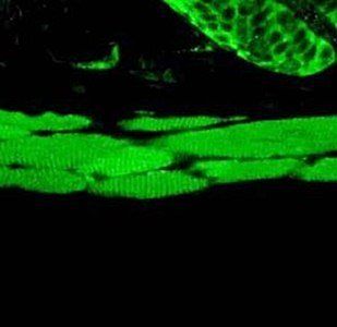 HSP70 antibody