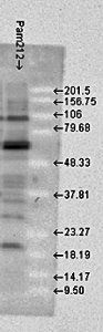 HSP70 antibody