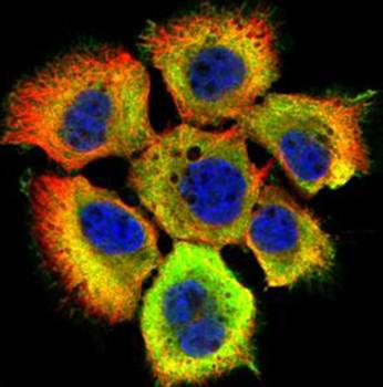 HSP70 Rabbit Polyclonal Antibody
