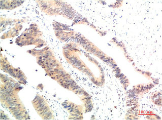 HSP90AA1 Antibody