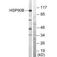 HSP90AB1 (Ab-254) Antibody
