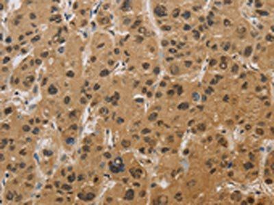 HSPA4 Antibody