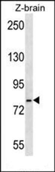 HSPA5 antibody