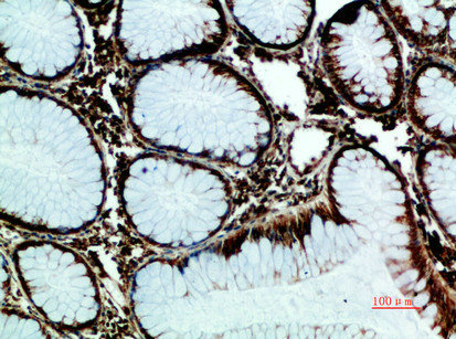 HSPA5 Antibody