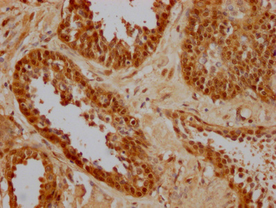 HSPA8 Monoclonal Antibody