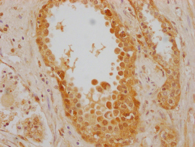 HSPA8 Monoclonal Antibody