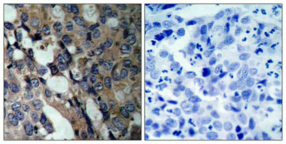 HSPB1 (Ab-15) Antibody