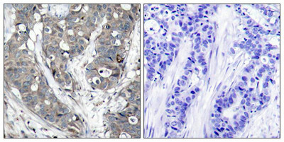 HSPB1 (Ab-78) Antibody