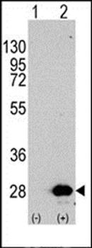 HSPB1 antibody