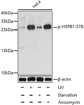 HSPB1 (Phospho-S78) antibody