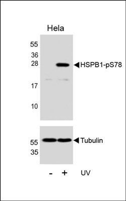HSPB1 (phospho-Ser78) antibody