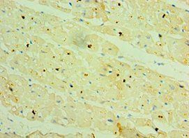 HSPB2 Antibody