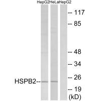 HSPB2 antibody