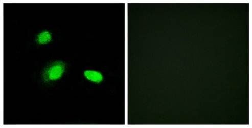 HSPB2 Antibody