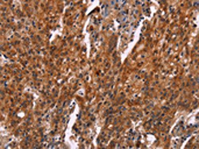 HSPB6 Antibody