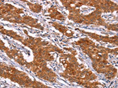 HSPB6 Antibody