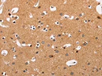 HSPB8 Antibody