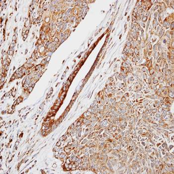 HSPB8 antibody
