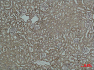HSPD1 Antibody