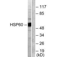HSPD1 antibody