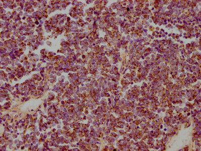 HSPD1 antibody