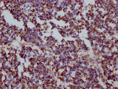 HSPD1 Recombinant Monoclonal Antibody