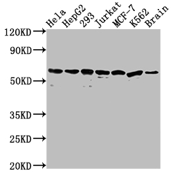 HSPD1 Recombinant Monoclonal Antibody