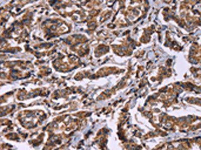 HSPE1 Antibody