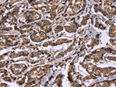 HSPE1 antibody