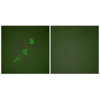 HSPE1 Antibody