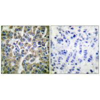 HSPE1 Antibody