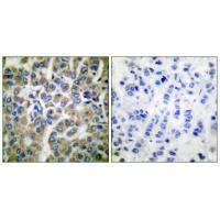 HSPE1 antibody