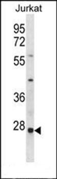HTATIP2 antibody