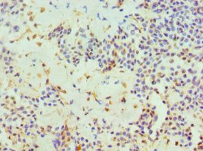 HTATIP2 Antibody