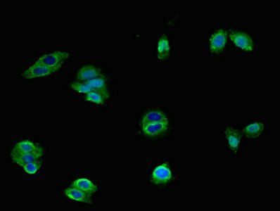 HTR1A antibody