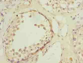 HTR1E Antibody