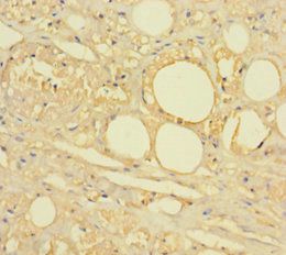 HTR2A Antibody