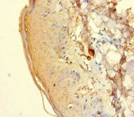 HTR2A Antibody