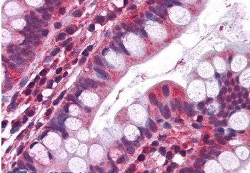 Goat anti-Serotonin receptor 3A / HTR3A Antibody
