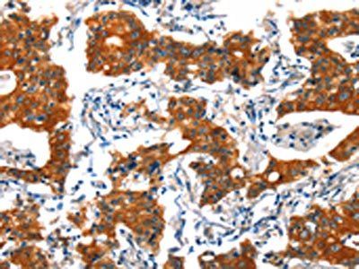 HTR3B Antibody