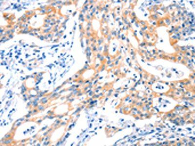 HTR3B Antibody