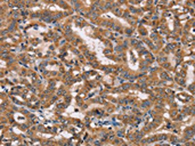 HTR3C Antibody