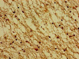 HTR4 Antibody