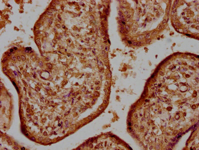 HTRA1 antibody