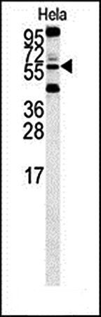 HtrA1 antibody
